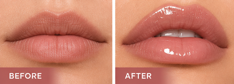 REVOLUTION “Hydra Bomb” Lip Gloss Hydra Bomb with Peptides & Hyaluronic Acid 4.6 mL