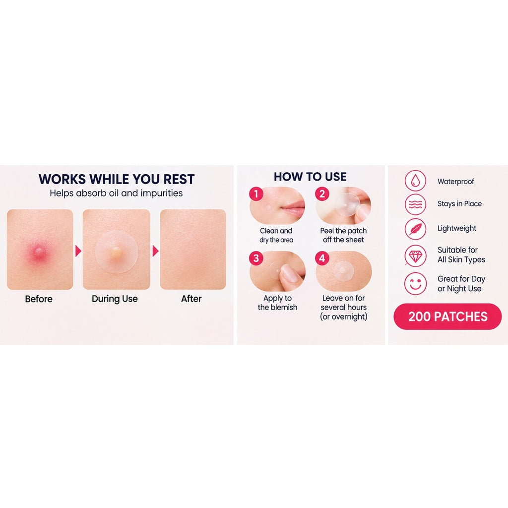 200 Pcs Hydrocolloid Pimple Patches – Transparent Waterproof Acne Spot Stickers