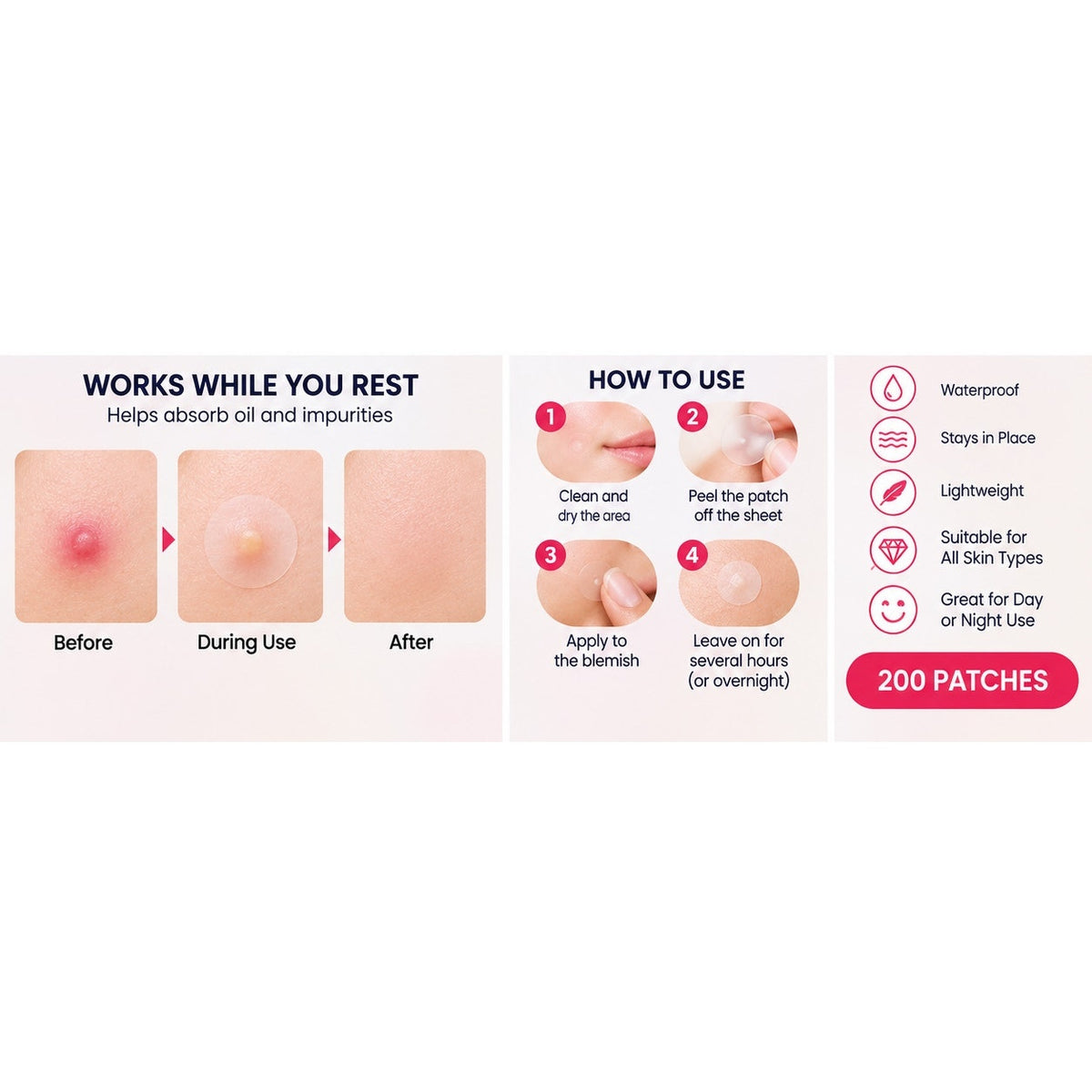 200 Pcs Hydrocolloid Pimple Patches – Transparent Waterproof Acne Spot Stickers